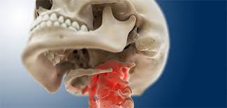 Bei Zervikalem Schwindel Hand Anlegen