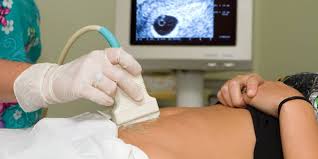 Es la interrupción natural de la gestación antes de la semana 20 de embarazo, que ocurre de manera involuntaria y termina definitivamente en la pérdida del embrión o feto. Aborto Que Es Y Por Que Ocurre Cuidateplus