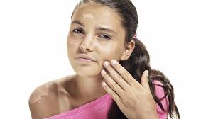 Jun 02, 2021 · perlu diketahui, tipe kulit wajah juga dapat berubah seiring dengan bertambahnya usia serta beberapa faktor genetik, penyakit bawaan, dan faktor lingkungan seperti paparan sinar matahari dan polusi. 10 Cara Atasi Kulit Perih Akibat Paparan Sinar Matahari Okezone Lifestyle