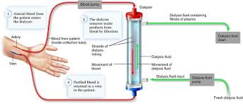 Check spelling or type a new query. 17 Dialysis Ideas Dialysis Dialysis Nurse Kidney Disease