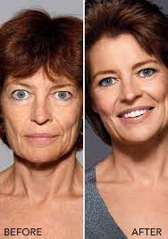 How To Cover Age Spots You Don T Need Expensive Surgery For This Fix Bobbi Brown Shares H Bobbi Brown Makeup Tutorial Brown Makeup Looks Bobbi Brown Makeup