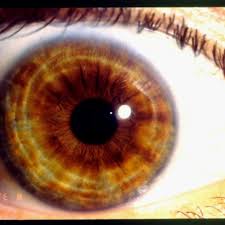 How To Read Eyes Iridology By Color Iridology Software
