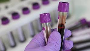 At least one respiratory sample must be positive by the cdc for it to be once a case has been tested and labeled presumptive positive by state or local officials, that information is released to the general public. Uae Private Hospitals Roll Out Antibody Test For Covid 19 Healthcare It News