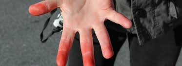 Frostbite 03 july 2010 | ugo movies. Frostbite Boy Scouts Of America