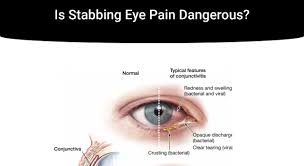 Image result for Eye Pain without Redness