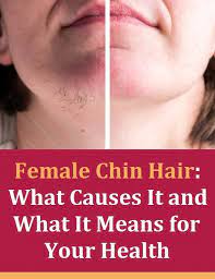 But when these amounts are too high, they can cause hirsutism and other things, like acne, a deep voice. Female Chin Hair What Causes It And What It Could Tell You About Your Health Chin Hair Female Facial Hair Chin Hair Causes