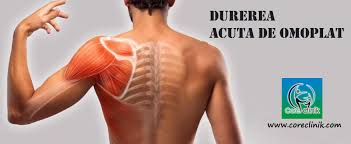 Durerea nu este intensa, însă este deranjantă. Core Clinik Durerea Acuta De Omoplat Poate Nu È™tiai Facebook