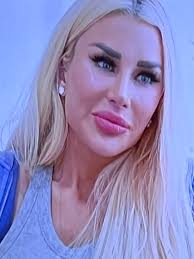 A young woman recently took to social media to document her journey  undergoing fox eye surgery, a controversial cosmetic procedure designed to  lift and elongate the eyes. Sharing every step—from consultations to