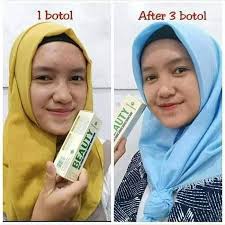 Mbak Berapa Lama Hasil Pemakaiannya Natura Beauty Spray Facebook 10 krim pelembap 'moisturizer' untuk memutihkan wajah sepuluh krim pelembap untuk memutihkan kulit wajah (foto: natura beauty spray