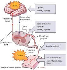 Blog Pre Emptive Pain Management