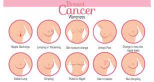 Secondary breast cancer happens when cancer cells spread from the breast to other parts of the body. What Is Breast Cancer Causes And Symptoms Of Breast Cancer