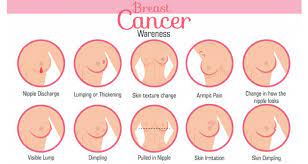 Men can get breast cancer and benign breast conditions too, although it is much less common. What Is Breast Cancer Causes And Symptoms Of Breast Cancer
