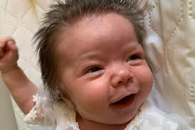 Fundraiser for Oliver Wallace by William Wallace : Felicity Wallace Hurler  Syndrome Journey