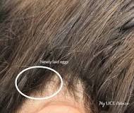 Image result