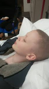 Aaron getting his cast