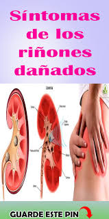 Pin On Salud