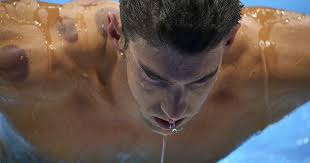 The practice dates back more than 2,000 years, according to jill blakeway, doctor of. Cupping Therapy At Rio Olympics Africanews
