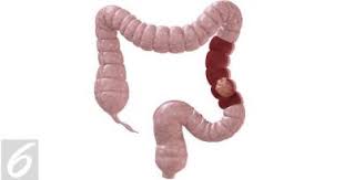 Ibu hamil memang rentan sekali merasakan sakit pada beberapa bagian tubuh, termasuk dada. Nyeri Dada Saat Hamil Apa Penyebab Dan Bahayanya Info Sehat Fkui