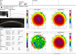 We did not find results for: In Ce Consta Un Consult Oftalmologic Reginamaria Ro