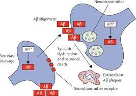Alzheimer S Disease The Lancet