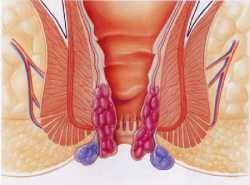 Plus de sujets relatifs à : Vous Allez Avoir Une Intervention De Longo Snfcp