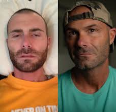 I often think about the ones we've lost 💔 Millions across the world have  felt the wrath of addiction—whether they were the ones using or the ones  who loved them. Addiction is