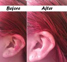 Let the dishwashing soap do it. Useful Ideas On How To Remove Hair Dye From Skin Alldaychic