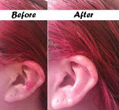 So how do you get hair dye off your skin without it turning into a blotchy mess? Useful Ideas On How To Remove Hair Dye From Skin Alldaychic