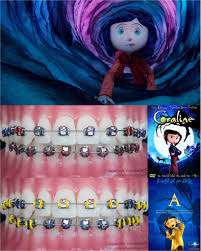 Coraline Braces Colors Braces Colors Cute Braces Cute Braces Colors
