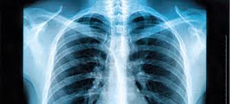 Buzzfeed staff the more wrong answers. 47 Radioactive X Ray Facts And Trivia Fact Retriever