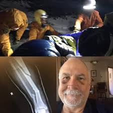 Broken Leg Update: A Year Later and Future Climbing Plans