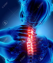 Maybe you would like to learn more about one of these? Ilustracion 3d Cuello Doloroso Columna Cervical Esqueleto De Rayos X Concepto Medico Fotos Retratos Imagenes Y Fotografia De Archivo Libres De Derecho Image 85804017