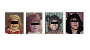 Only two treatments, cognitive behavioral therapy (cbt) and graded exercise therapy (get), have demonstrated reproducible evidence for their efficacy in people with cfs who are walking. Riley Day Syndrome Symptoms Causes And Treatment Nuovo