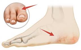 We did not find results for: Dry Cracked Feet Treatment Causes And Home Remedies