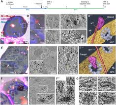 Maybe you would like to learn more about one of these? Cone Shaped Hiv 1 Capsids Are Transported Through Intact Nuclear Pores Biorxiv