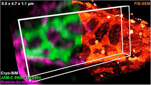 Correlative Three Dimensional Super Resolution And Block Face Electron Microscopy Of Whole Vitreously Frozen Cells Biorxiv