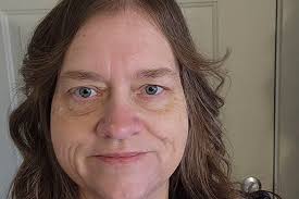 Fundraiser by Jennifer Tukey : Alone and in Need: Help Fund My Surgery