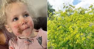 Mum's warning after toddler suffers extreme burns from brushing up against  plant