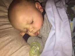 Hey mommas. My son is 9 months old and has hemophilia B. He has a broviac  line and the last 2 dressing changes it's looked irritated. He was  scratching it last week