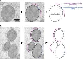 I forget to turn it down, combine the matlab and cellpofiler to identify mitochondria and calculate their features. The Coming Of Age Of The Mitochondria Er Contact A Matter Of Thickness Cell Death Differentiation