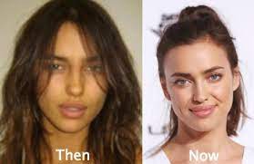 However, a source told page six that he had tried to pursue her long before he started dated kim. Photo Credit Right Bennett Raglin Getty Images Cosmetic Surgery Plastic Surgery Beauty Treatments