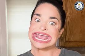 Maine Woman Now Holds the World Record for Largest, Widest Mouth