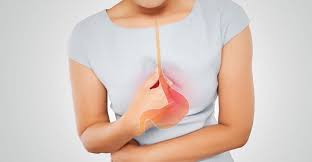 Bệnh trào ngược dạ dày thực quản (gerd) xảy ra khi lượng dịch dạ dày trào ngược lên thực quản vượt quá giới hạn bình thường, gây ra các triệu chứng có hoặc không kèm. Bá»‡nh Trao NgÆ°á»£c Dáº¡ Day Thá»±c Quáº£n K21 La Gi Cach Chá»¯a Táº­n Gá»'c
