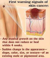 Pin On Melanoma