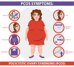 Polycystic ovary syndrome (pcos) is the most common endocrine disorder in women of reproductive age that is characterized by reproductive and metabolic disorders. Pcos What You Need To Know Fertility Center Of Dallas