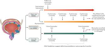 Bladder cancer is a common type of cancer that begins in the cells of the bladder. Urinary Biomarkers To Mitigate Diagnostic Delay In Bladder Cancer During The Covid 19 Era Nature Reviews Urology