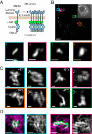 Faktor persekutuan terbesar (fpb) dari 27 dan 45 adalah. Quantitative Microscopy Reveals Dynamics And Fate Of Clustered Ire1a Pnas