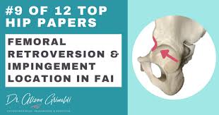 Image result for Femoral Retroversion
