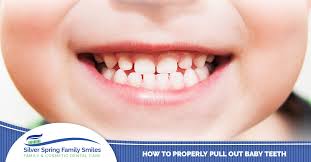 If your child has a loose tooth and you are in confusion whether to pull out the loose tooth or not, then you should go through this article. Silver Spring Dental How To Properly Pull Out Baby Teeth