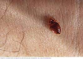 Si usted desecha un colchón o un mueble que tiene chinches, usted, de alguna forma, debe destruirlo para que nadie lo pueda usar y contraer las chinches. Chinches Sintomas Y Causas Mayo Clinic